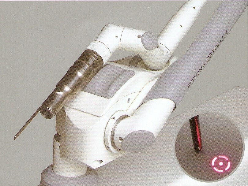 Laser QXMAX de Fotona con sitema OPTOflex