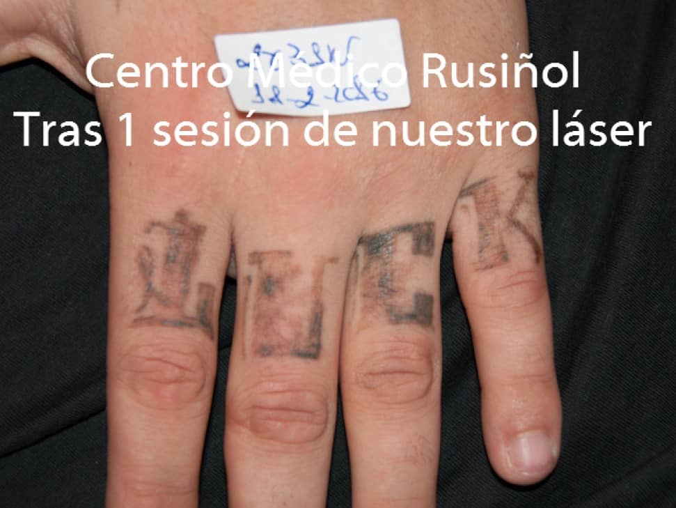 Tatuajes dedos 1s