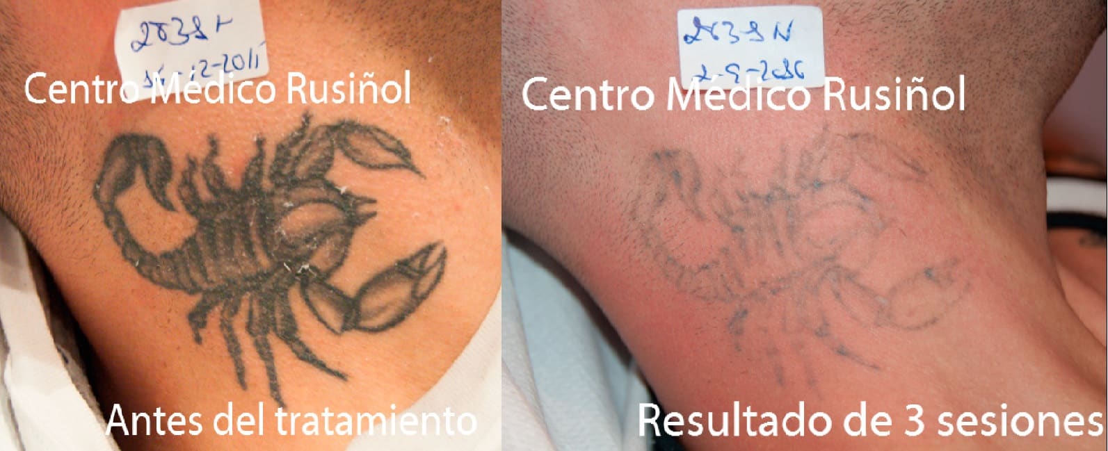 tatuaje-cuello-3s-ayd