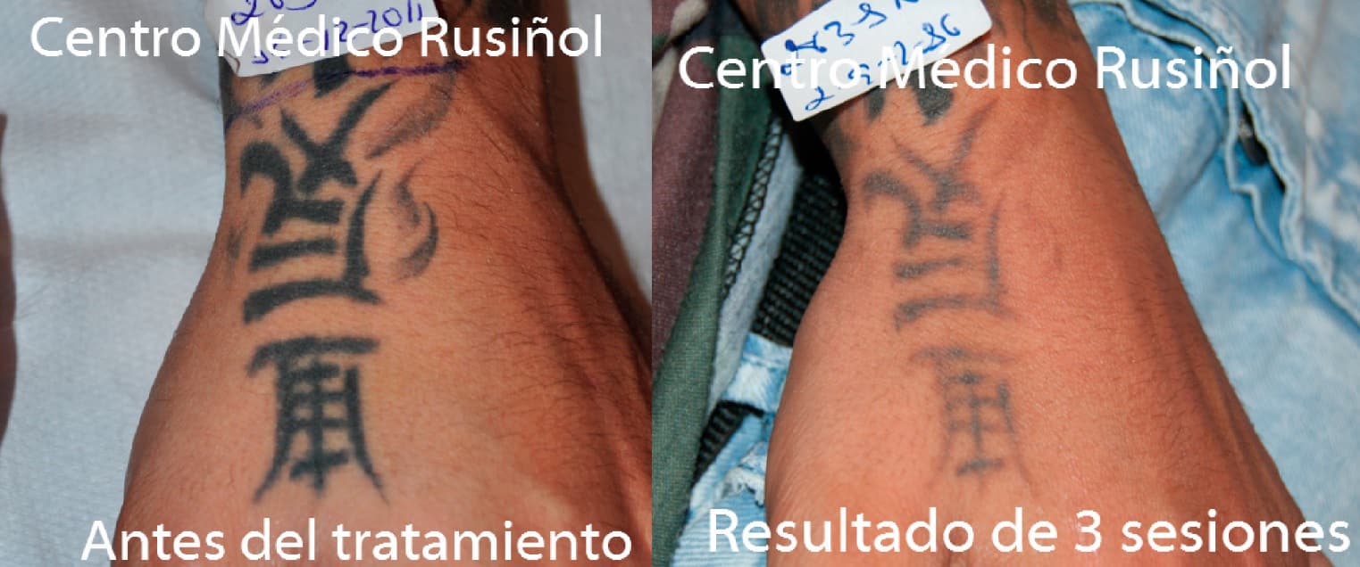 tatuaje-mano-letras-ch-3s-ayd